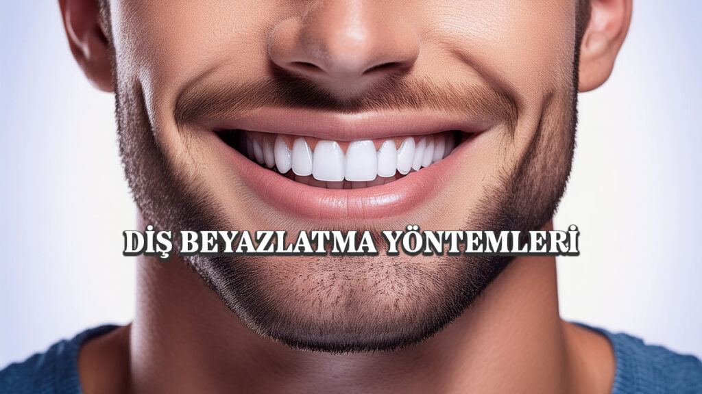 Diş Beyazlatma Yöntemleri